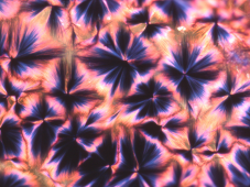 Birefringence pattern of a sample positive to Ebola infection.
